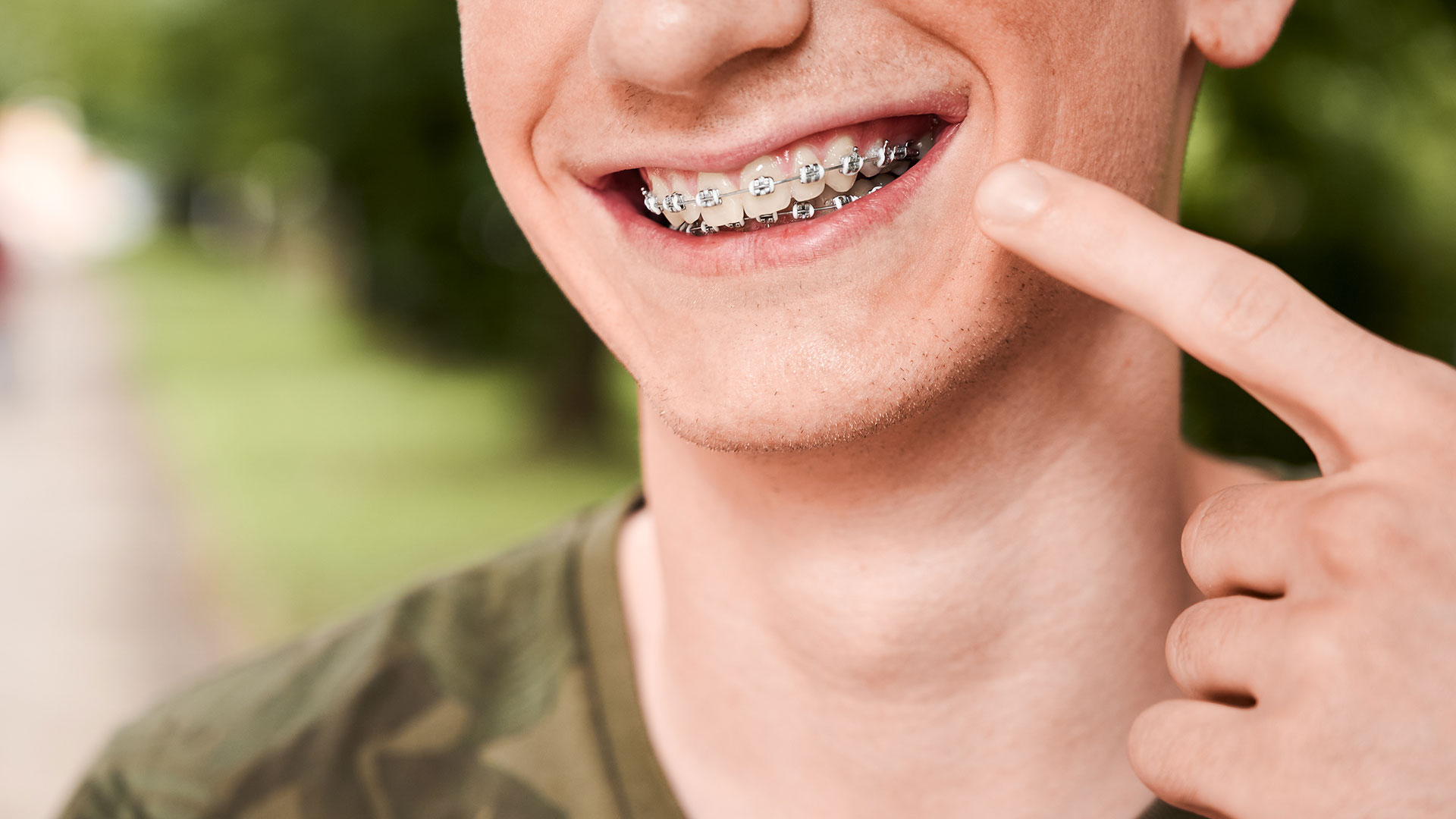 Ragazzo sorridente con apparecchio ortodontico fisso che indica i denti, simbolo della corretta pulizia dei denti con l'apparecchio per bambini e adulti.