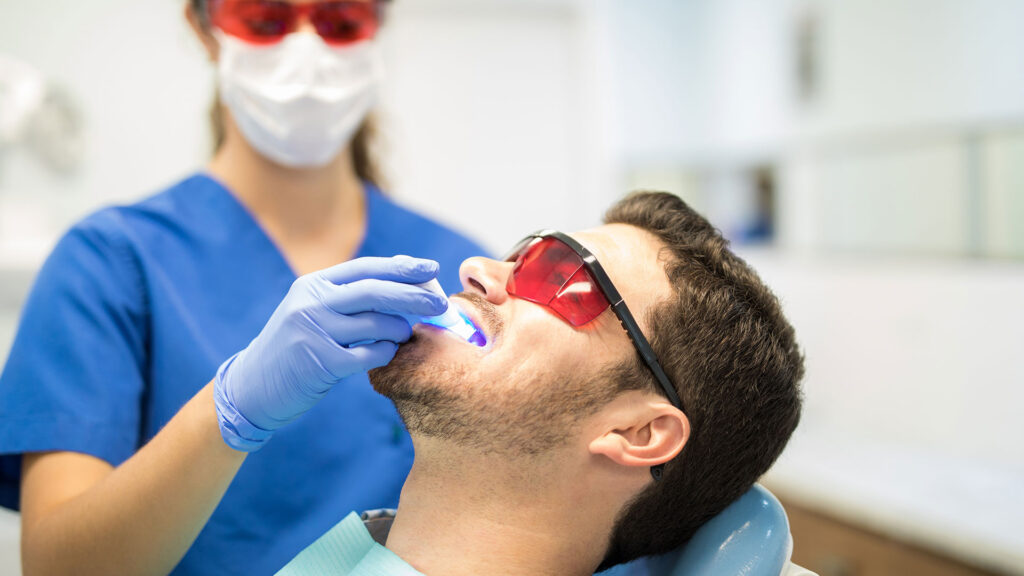 Uomo che riceve un trattamento professionale di sbiancamento dentale