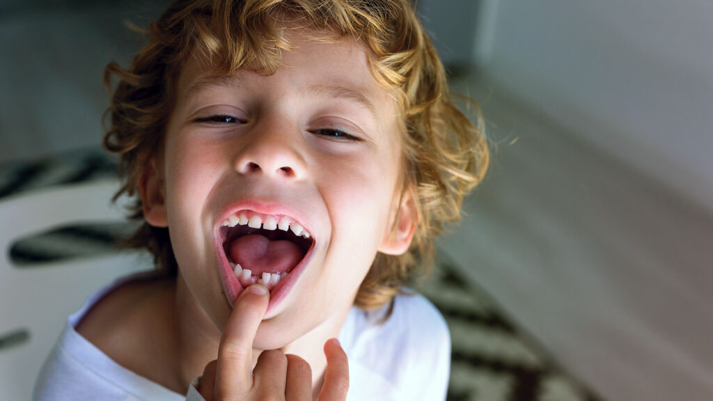 Come far cadere un dente in modo sicuro e naturale