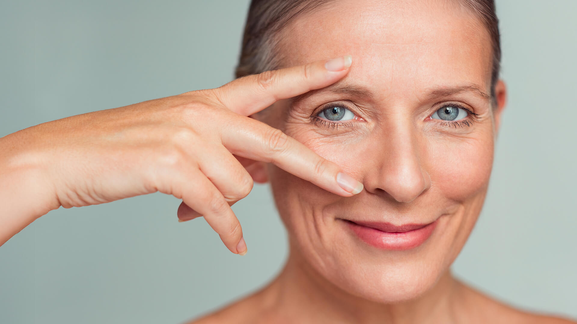 Botox fronte e contorno occhi | Torino | Studio Cemisa