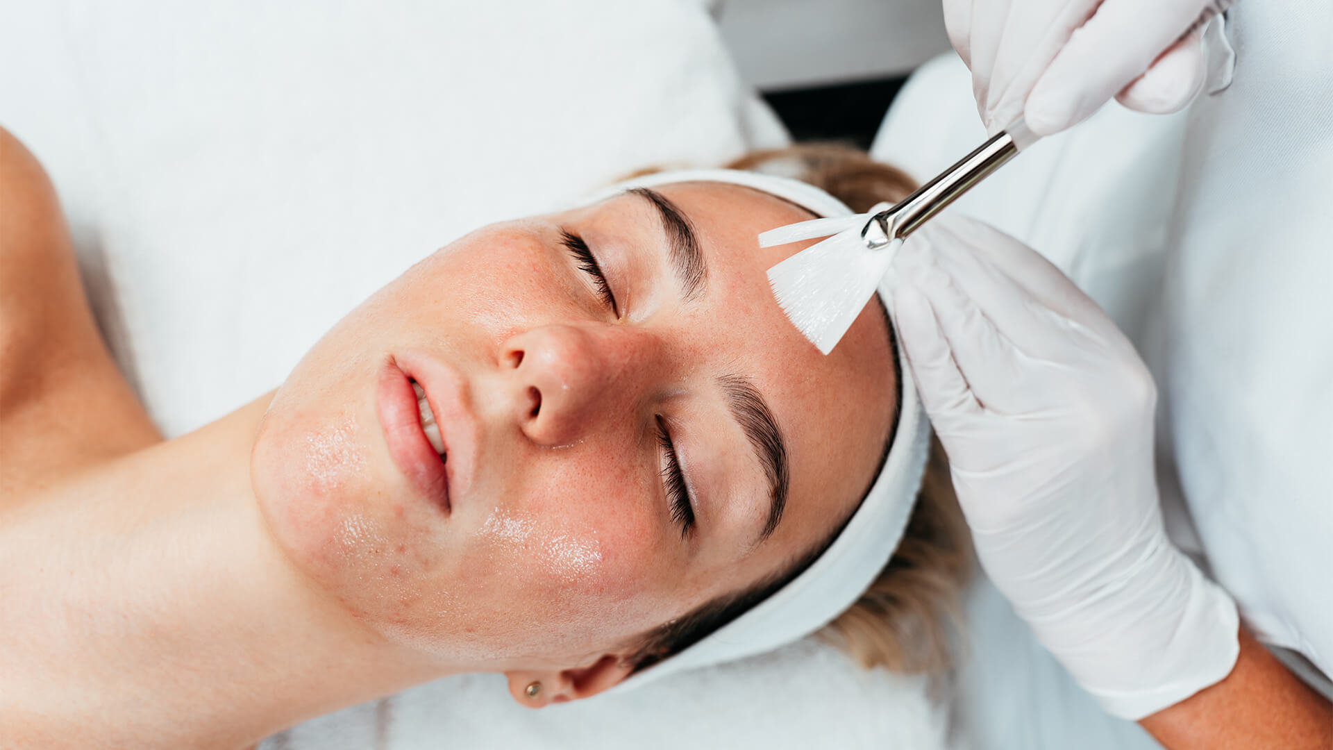 Foto di una ragazza che si sottopone a un peeling viso