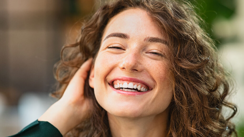 Foto di una ragazza con il gummy smile, risolvibile con il botox