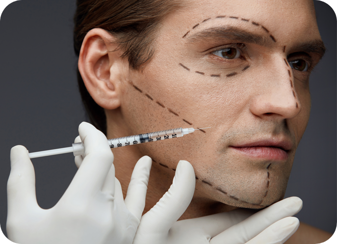 Trattamenti viso iniettivi | Filler, tossina botulinica, biostimolazione | Studio Cemisa a Torino