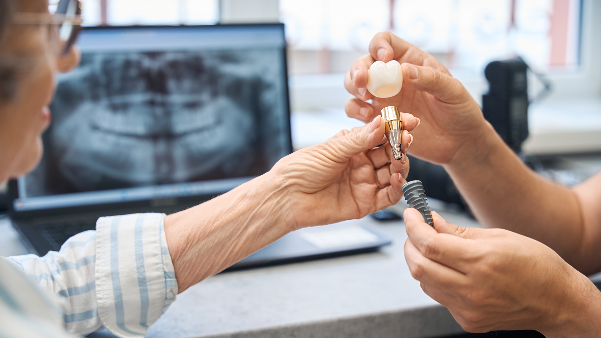 Foto di un igienista che mostra al paziente come pulire un impianto dentale