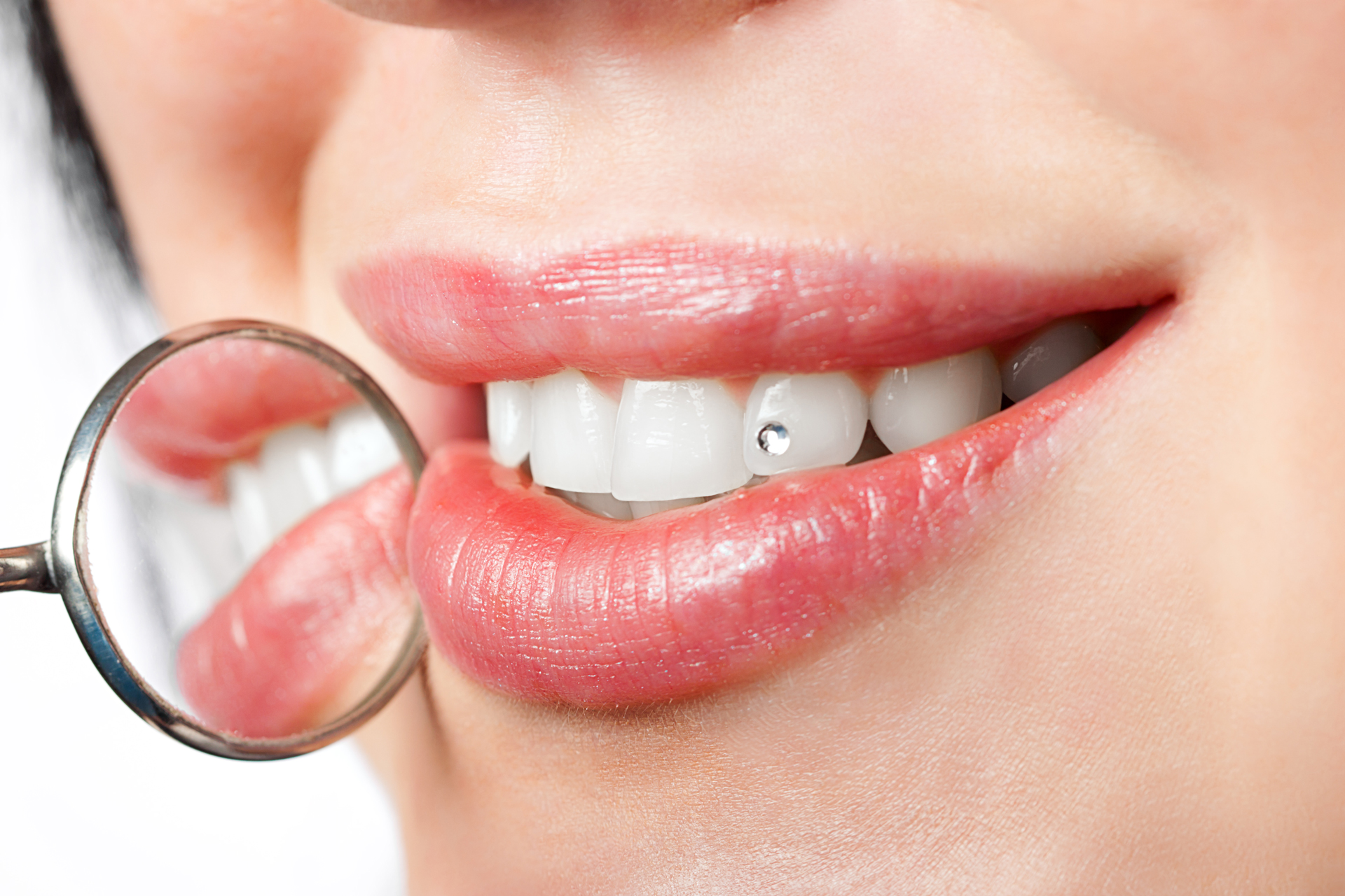 Foto di un brillantino applicato sul dente