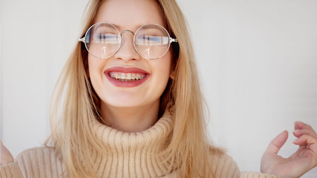 Quando mettere l’apparecchio ai denti da adulti?